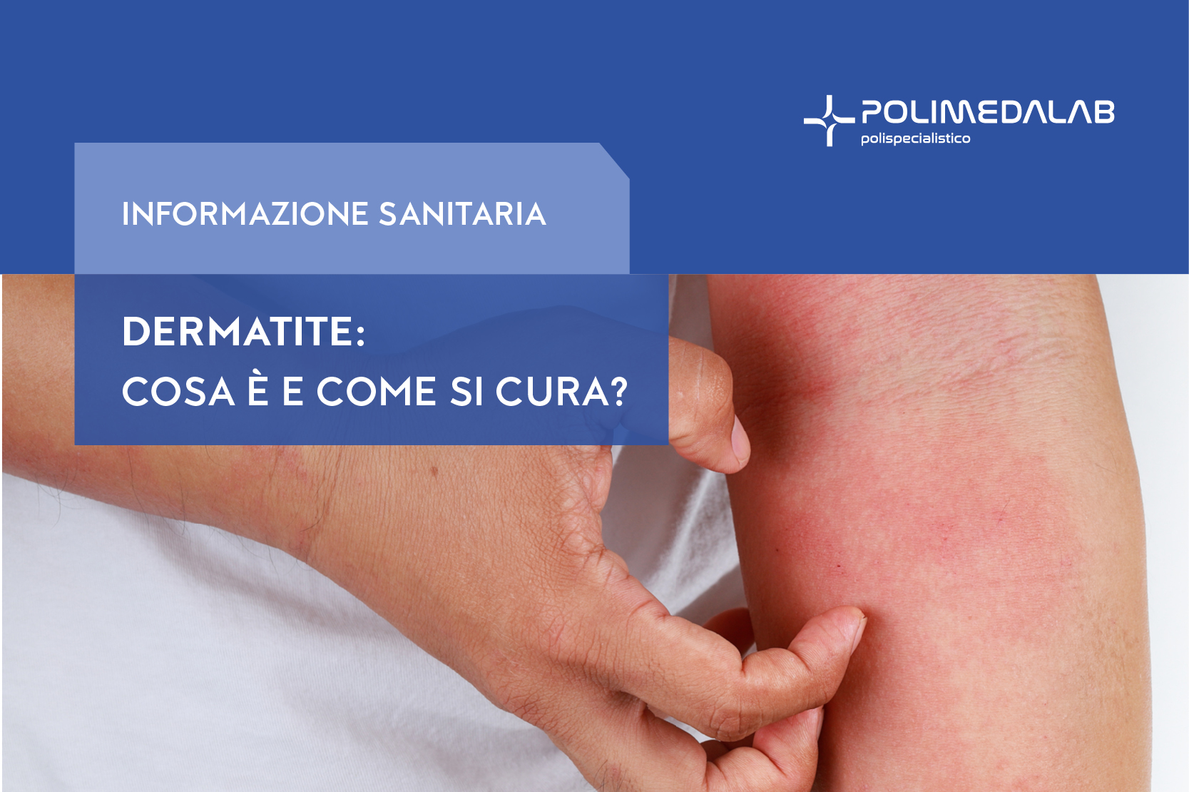 dermatite tipologie e cura